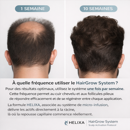 Helixa - Système de repousse Capillaire