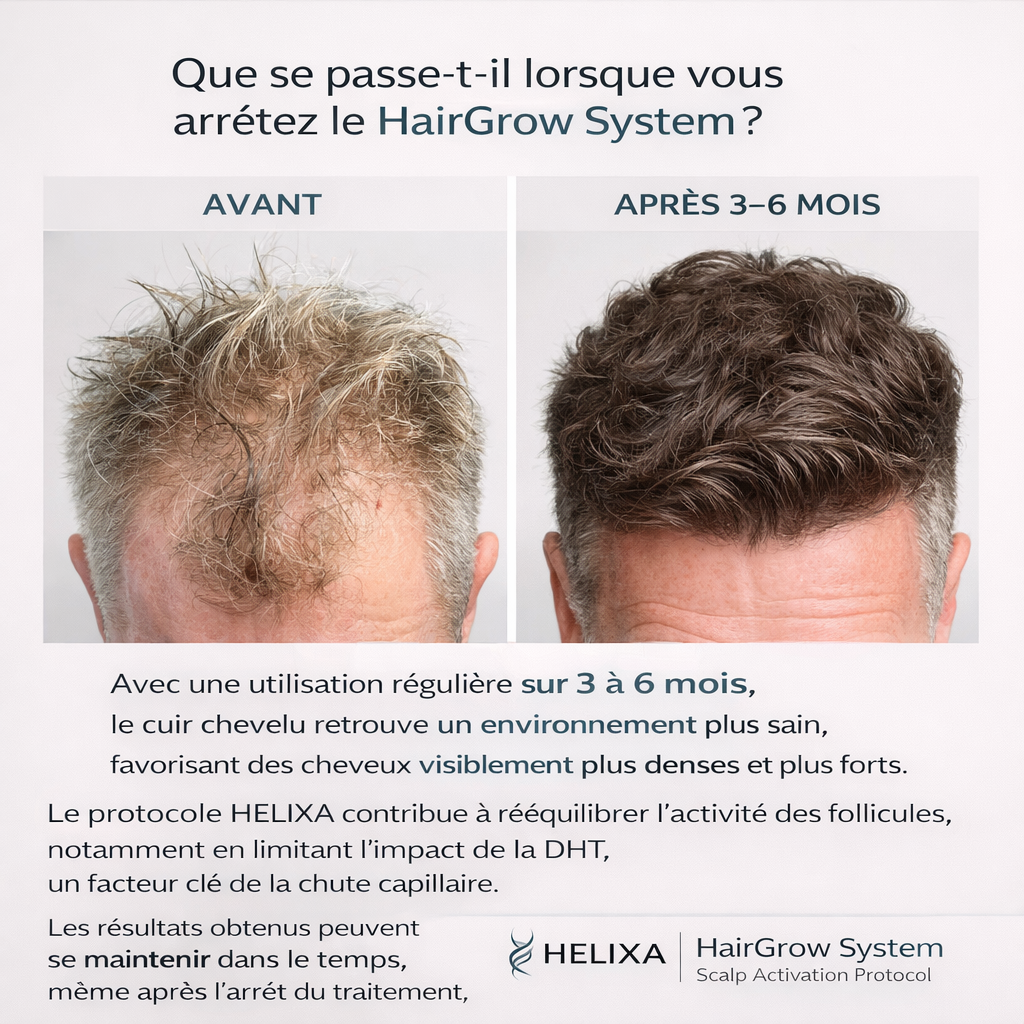 Helixa - Système de repousse Capillaire
