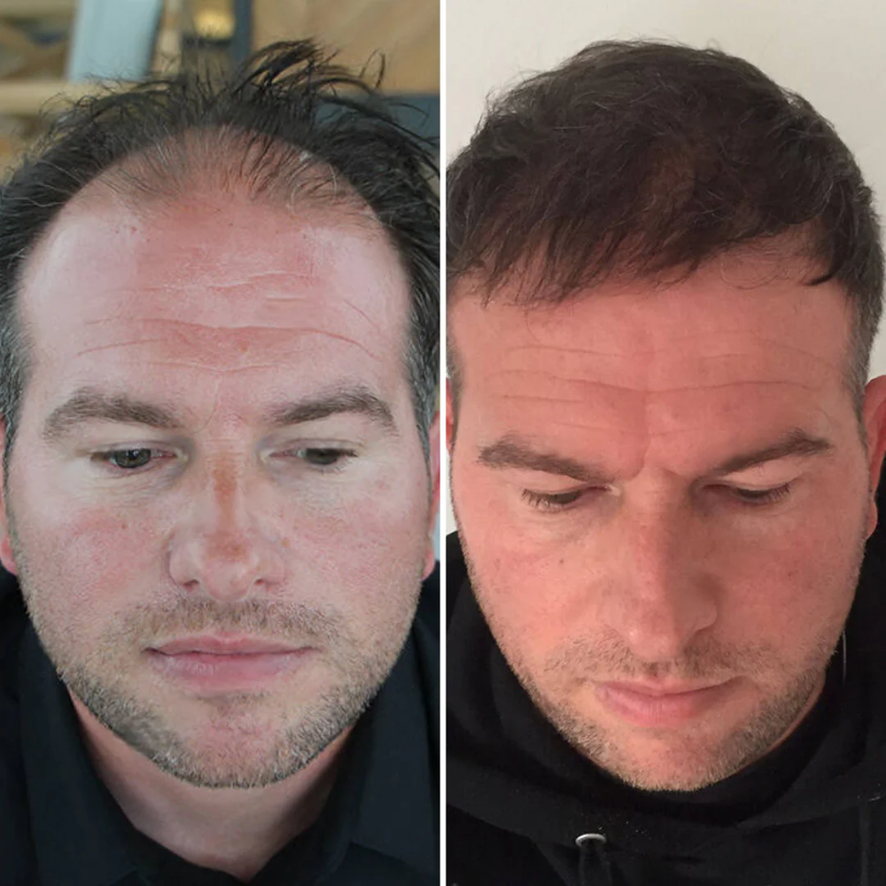 <h2>⭐⭐⭐⭐⭐<br/>Découvrez pourquoi <strong>plus de 10 000 Clients</strong> adorent nos produits… </h2>