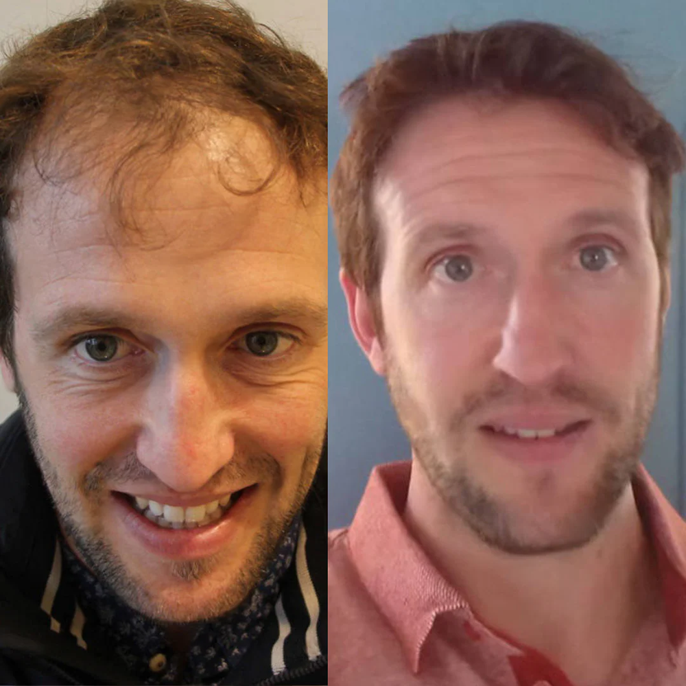 <h2>⭐⭐⭐⭐⭐<br/>Découvrez pourquoi <strong>plus de 10 000 Clients</strong> adorent nos produits… </h2>