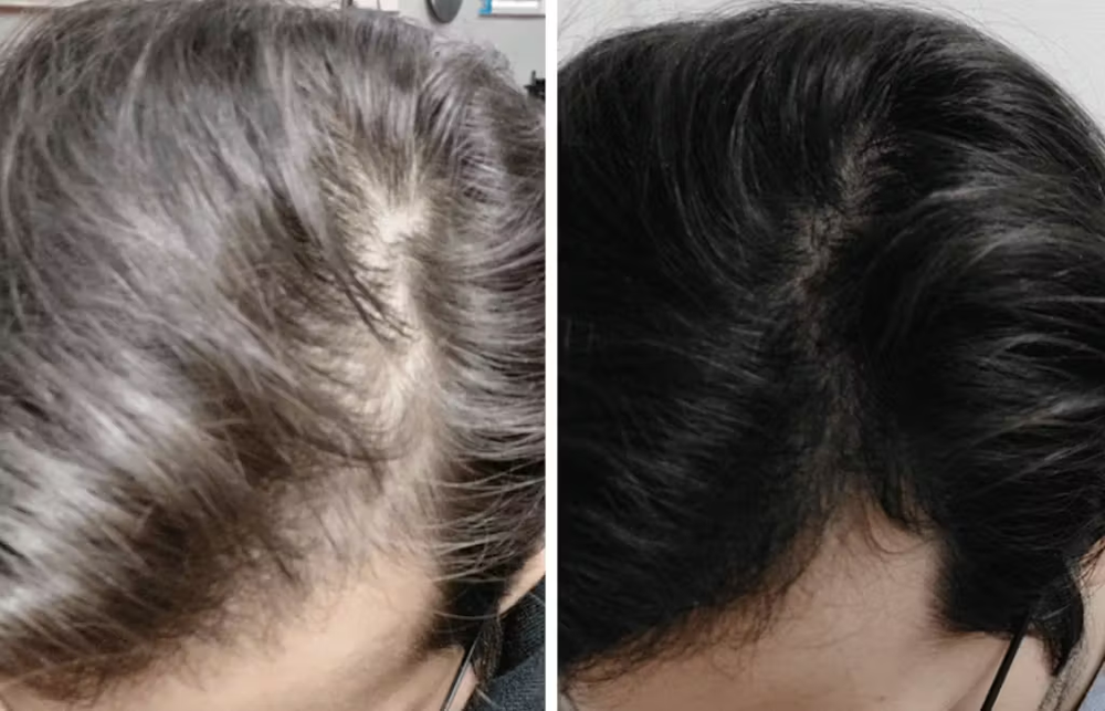 <h2>⭐⭐⭐⭐⭐<br/>Découvrez pourquoi <strong>plus de 10 000 Clients</strong> adorent nos produits… </h2>