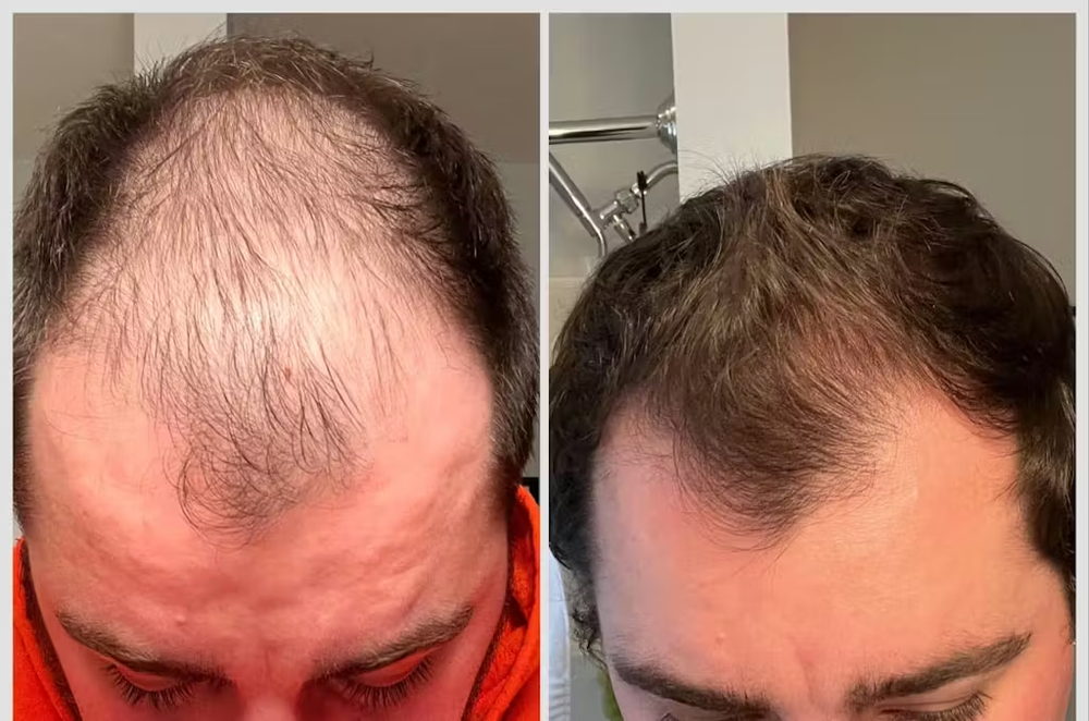 <h2>⭐⭐⭐⭐⭐<br/>Découvrez pourquoi <strong>plus de 10 000 Clients</strong> adorent nos produits… </h2>